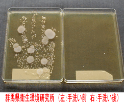 手のひらに付着した細菌を培養した結果（左：手洗い前、右：手洗い後）